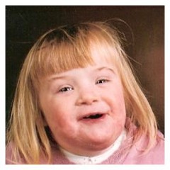 Down_syndrome.jpg