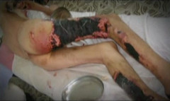 krokodil-drug.jpg