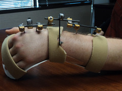 injured-worker.jpg injured-worker.jpg