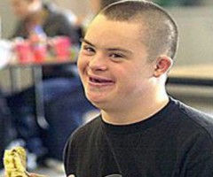 Downs-Syndrome2.jpg