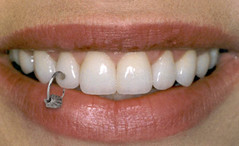 Teeth-Jewelry-3111.jpg