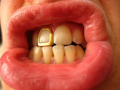 framedtooth.jpg