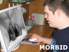 Morbid Doublepenis.png