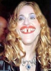 buck-teeth-girl.jpg
