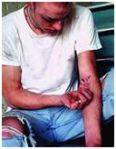 0808_needle-drug.jpg