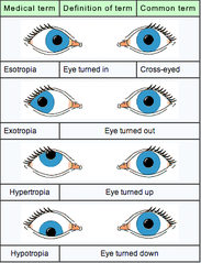 strabismus.png