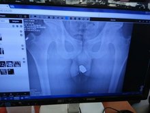 X-Ray Technician Finds Family Jewel.jpg