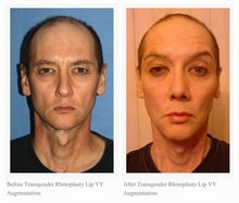 bf6c09e18a11edcb6b8d4beea25c2cefjpg