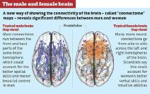 differences-male-female-brain.jpg