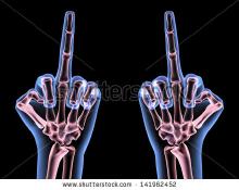 stock-photo-x-ray-hands-showing-a-m.jpg
