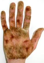 hair on palms fapfap.jpg