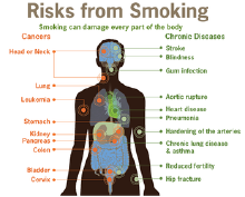 Smoking Risks_form_smoking-smoking_.png