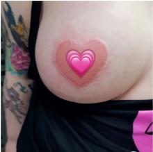 Heart shaped areola 2.jpg