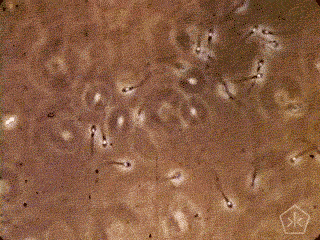 Sperm gif.gif